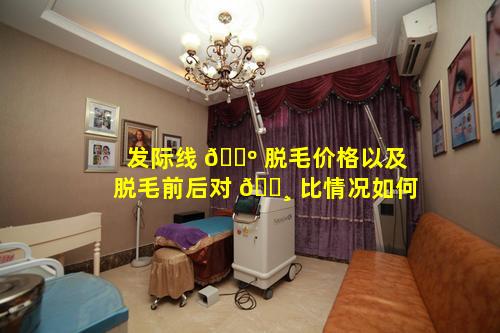 发际线 🌺 脱毛价格以及脱毛前后对 🌸 比情况如何